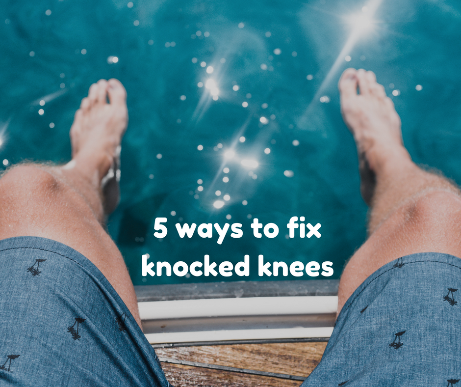 5 ways to fix knocked knees