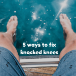 5 ways to fix knocked knees